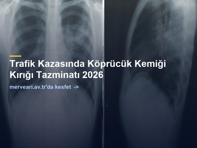 Trafik Kazasında Köprücük Kemiği Kırığı Tazminatı 2026 — merveari.av.tr